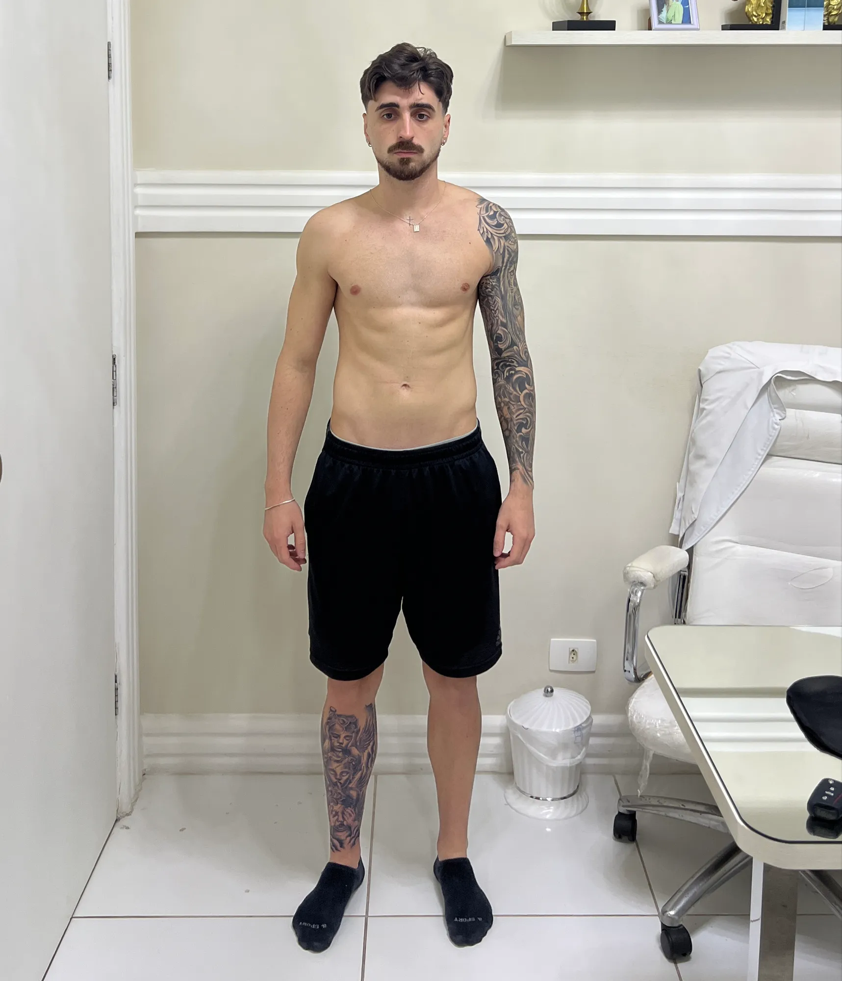 Guilherme Duarte — Frontal — depois